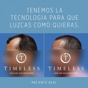 Slider image (2) Timeless Hair & Skin Medcenter